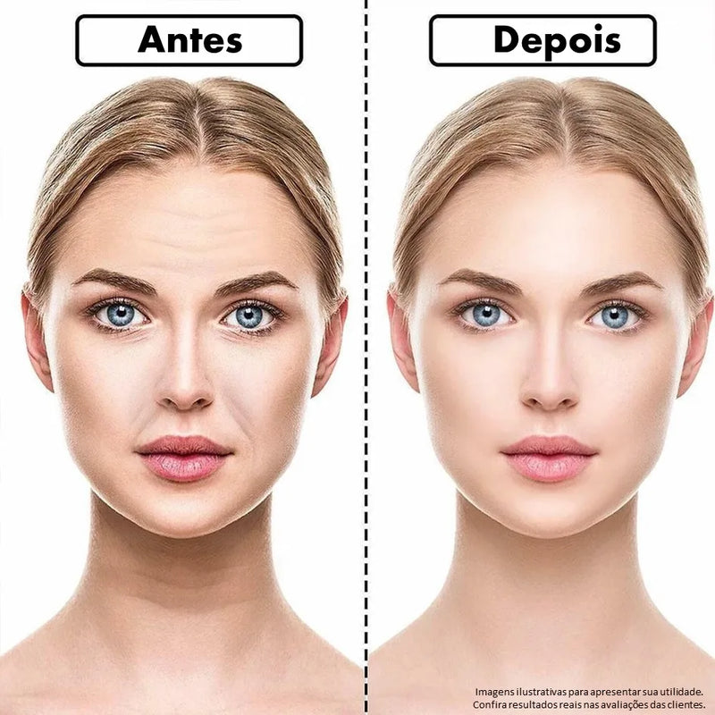 adesivos anti rrugas para rosto
